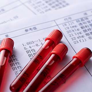 血藥檢測